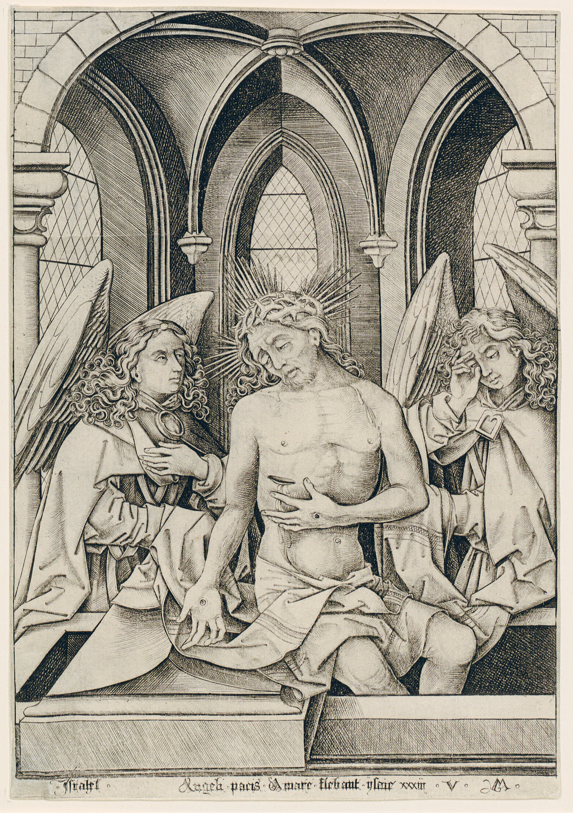 Israhel van Meckenem: Muž bolesti. Okolo 1490 – 1500. Majetok: Graphische Sammlung ETH, Zürich